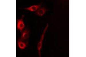 ABIN6277853 staining HeLa cells by IF/ICC. (CASP5 anticorps)