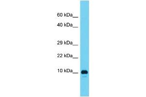 Host: Rabbit  Target Name: RGD1561459  Sample Tissue: Rat Testis lysates  Antibody Dilution: 1. (AAMDC anticorps  (N-Term))