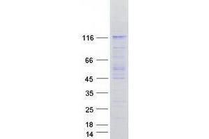 Validation with Western Blot (USP1 Protein (Transcript Variant 3) (Myc-DYKDDDDK Tag))