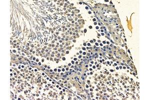 ABIN7096864 and ABIN7100930 at 1/100 staining rat testis tissue by IHC-P. (NAA25 anticorps)