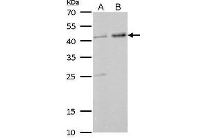 WB Image GNAS antibody [C2C3-2], C-term detects GNAS protein by Western blot analysis. (GNAS anticorps)
