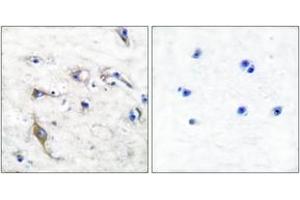 Immunohistochemistry analysis of paraffin-embedded human brain tissue, using JM4 Antibody. (PRAF2 anticorps  (AA 129-178))