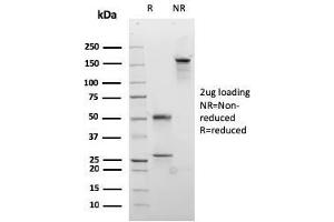 SDS-PAGE Analysis Purified Desmocollin-2/3 Recombinant Mouse Monoclonal Ab (rDSC2/3437).