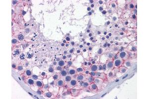 Immunohistochemistry (IHC) image for anti-Tight Junction Protein 1 (TJP1) (Middle Region) antibody (ABIN2774876) (TJP1 anticorps  (Middle Region))