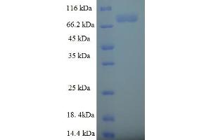 SDS-PAGE (SDS) image for Tripartite Motif Containing 9 (TRIM9) (AA 1-550), (full length) protein (His-SUMO Tag) (ABIN5711885)