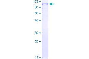 Image no. 1 for Zinc Finger Protein 650 (ZNF650) (AA 1-741) protein (GST tag) (ABIN1324474)