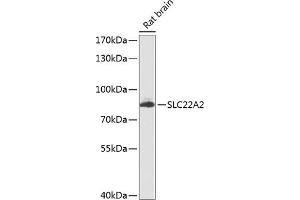 Western blot analysis of extracts of rat brain, using SLC22 antibody (ABIN6129480, ABIN6147887, ABIN6147889 and ABIN6224517) at 1:1000 dilution.