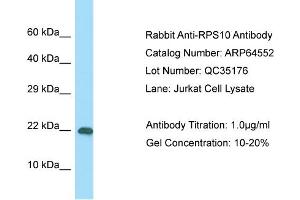 Western Blotting (WB) image for anti-Ribosomal Protein S10 (RPS10) (C-Term) antibody (ABIN2789874) (RPS10 anticorps  (C-Term))