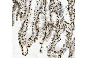 IHC analysis of PRDM5 using anti-PRDM5 antibody (ABIN7600853). (PRDM5 anticorps  (AA 24-630))