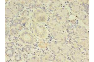 Immunohistochemistry of paraffin-embedded human pancreatic tissue using ABIN7173738 at dilution of 1:100 (TBCA anticorps  (AA 2-108))