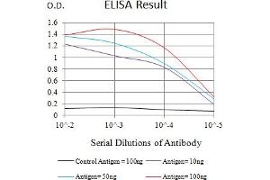 Black line: Control Antigen (100 ng),Purple line: Antigen (10 ng), Blue line: Antigen (50 ng), Red line:Antigen (100 ng)