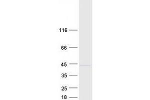 Validation with Western Blot