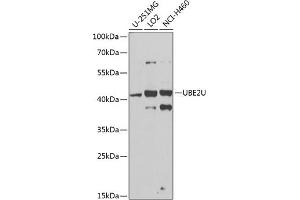Western blot analysis of extracts of various cell lines, using UBE2U antibody (ABIN6130858, ABIN6149825, ABIN6149826 and ABIN6224418) at 1:1000 dilution. (UBE2U anticorps  (AA 1-226))