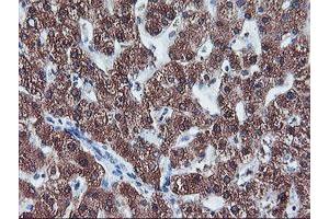 Immunohistochemistry (IHC) image for anti-Cytochrome P450, Family 2, Subfamily A, Polypeptide 6 (CYP2A6) antibody (ABIN1497724) (CYP2A6 anticorps)
