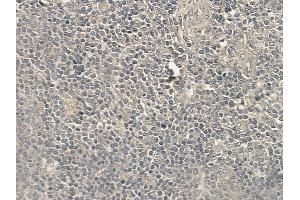 ABIN6256348 and ABIN6267205 at 1/100 staining human normal tonsil tissue by IHC-P.