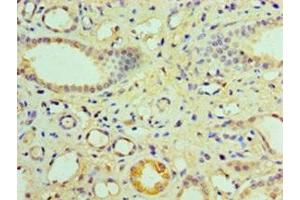 Immunohistochemistry of paraffin-embedded human kidney tissue using ABIN7161898 at dilution of 1:100 (NR1I3 anticorps  (AA 2-351))