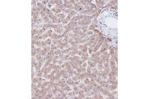 Immunohistochemical analysis of C on paraffin-embedded Human liver tissue was performed on the Leica®BOND RXm. (CBS anticorps  (AA 301-330))