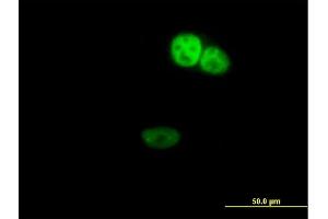 Immunofluorescence of purified MaxPab antibody to ZNF124 on HeLa cell.