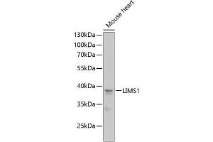 Western blot analysis of extracts of mouse heart, using LIMS1 antibody (ABIN6132048, ABIN6143232, ABIN6143234 and ABIN6218088) at 1:1000 dilution. (LIMS1 anticorps  (AA 1-325))