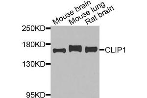Western blot analysis of extracts of various cell lines, using CLIP1 antibody (ABIN5975170) at 1/1000 dilution. (CLIP1 anticorps)