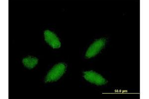Immunofluorescence of purified MaxPab antibody to PPARA on HepG2 cell. (PPARA anticorps  (AA 1-468))