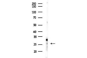 anti-Melanoma Antigen Family H, 1 (MAGEH1) (N-Term) antibody