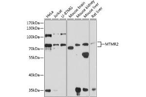 Western blot analysis of extracts of various cell lines, using MTMR2 antibody (ABIN6128322, ABIN6144156, ABIN6144157 and ABIN6224847) at 1:1000 dilution. (MTMR2 anticorps  (AA 404-643))