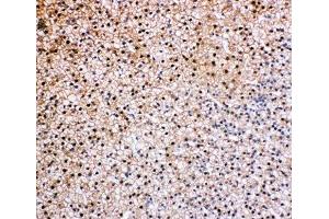 IHC-P: VCP antibody testing of rat epinephros tissue (VCP anticorps  (C-Term))