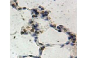 IHC-P analysis of Lung tissue, with DAB staining. (SIRT1 anticorps  (AA 244-498))