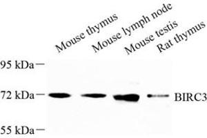Western blot analysis of BIRC3 (ABIN7073179) at dilution of 1: 500 (BIRC3 anticorps)