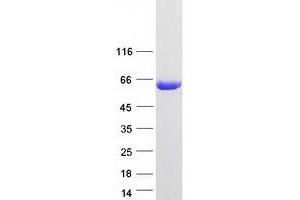 Validation with Western Blot