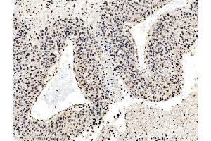 IHC analysis of DBC-1/CCAR2 using anti-DBC-1/CCAR2 antibody (ABIN7602235). (CCAR2 anticorps  (AA 65-917))