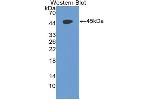 Western blot analysis of the recombinant protein. (CD97 anticorps  (AA 191-304))