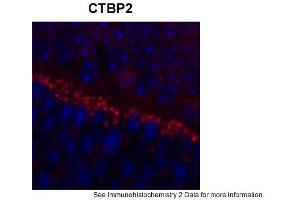 Sample Type: outer mouse plexiform layerRed: PrimaryBlue: DAPIPrimary Dilution: 1:200Secondary Antibody: Goat anti-Rabbit AF568 IgG(H+L)Secondary Dilution: 1:200Image Submitted by: David ZenisekYale University (CTBP2 anticorps  (Middle Region))