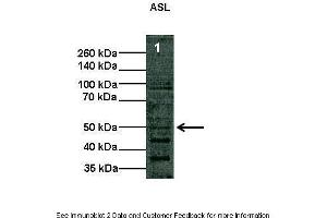 Lanes:   Lane1: 10 ug COS-7 cell lysate  Primary Antibody Dilution:   1:1000  Secondary Antibody:   Anti-rabbit HRP  Secondary Antibody Dilution:   1:2000  Gene Name:   ASL  Submitted by:   Shawn Elms.