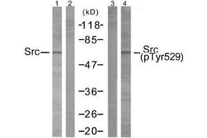 Western blot analysis of extracts from 293 cells using Src (Ab-529) antibody (E021168, Lane1 and 2) and Src (phospho-Tyr529) antibody (E011153, Lane 3 and 4). (Src anticorps  (pTyr529))