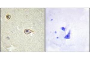 Immunohistochemistry analysis of paraffin-embedded human brain tissue, using Cytochrome P450 19A1 Antibody.