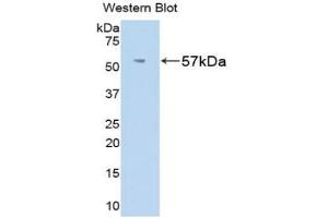 WB of Protein Standard: different control antibodies against Highly purified E. (Fibrinogen beta Chain Kit ELISA)