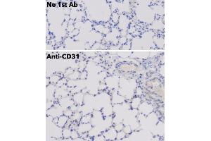 Immunohistochemistry (IHC) image for anti-Platelet/endothelial Cell Adhesion Molecule (PECAM1) (C-Term) antibody (ABIN6254202)
