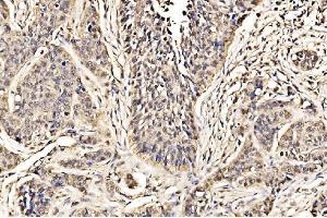 IHC analysis of ADRM1/ARM-1 using anti-ADRM1/ARM-1 antibody (ABIN7600108).