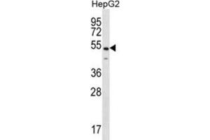 Western Blotting (WB) image for anti-NFKB Activating Protein (NKAP) antibody (ABIN2996720)