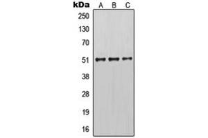 Western blot analysis of Cytokeratin 14 expression in MCF7 (A), mouse brain (B), rat brain (C) whole cell lysates.