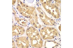 Immunohistochemistry of paraffin-embedded human kidney using PRKAG3 antibody (ABIN4904858) at dilution of 1:100 (40x lens).