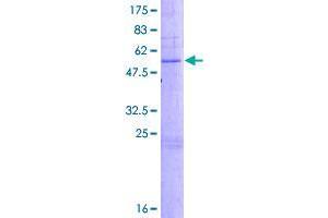 Image no. 1 for Chromosome 6 Open Reading Frame 25 (C6orf25) (AA 1-237) protein (GST tag) (ABIN1347617)