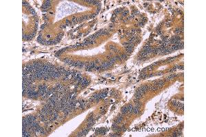 Immunohistochemistry of Human brain  using S100A13 Polyclonal Antibody at dilution of 1:40