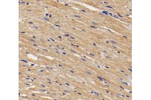 Immunohistochemistry analysis of paraffin-embedded mouse heart using,TMP1 (ABIN7076030) at dilution of 1: 1600 (Tropomyosin anticorps)