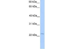 Human Placenta; WB Suggested Anti-C5orf39 Antibody Titration: 0. (Chromosome 5 Open Reading Frame 39 (C5orf39) (N-Term) anticorps)