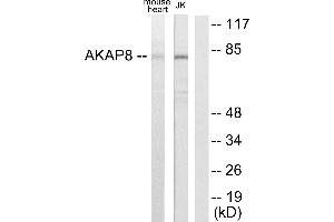 Immunohistochemistry analysis of paraffin-embedded human heart tissue using AKAP8 antibody. (AKAP8 anticorps)