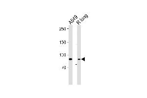 Western blot analysis of lysates from A549 cell line, rat lung tissue lysate (from left to right), using IDUA Antibody (Center) (ABIN651536 and ABIN2840285).