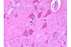 Human Brain, Cortex: Formalin-Fixed, Paraffin-Embedded (FFPE)